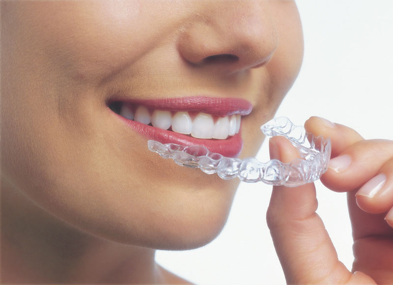 invisalign